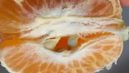 橘子瓣上的白絲是營養好物，能化痰止咳？