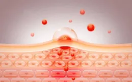 如何透過飲食對抗皮膚老化？