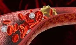 血管清道夫大盤點