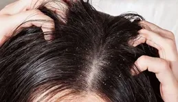 濕氣重的人，身上這4個地方會發臭，你有了幾個？