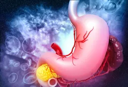 胃炎怎麽引起的？這些不良習慣正在悄悄傷胃