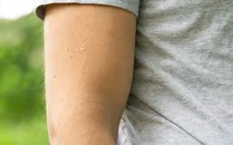 身上癢是什麽原因？這些潛在因素可能你都沒註意