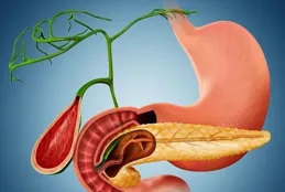 膽結石必須切除嗎？醫生幫你分析利弊