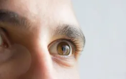 血脂高不高，眼睛會知？血脂高的人，眼睛通常會出現4個癥狀