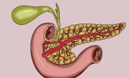 急性胰腺炎癥狀有哪些？快速掌握急性胰腺炎癥狀