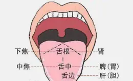 肝膽濕熱的人，舌頭上有這3個特征，教你1招，清肝膽，利濕熱！