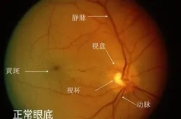 關於眼底雷射治療，這些知識一定要了解！看完別說還不知道