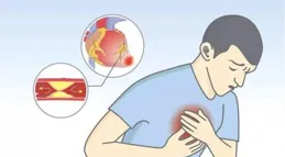 中西醫結合治療冠心病有何優勢？突發心梗，如何自救和救人？「黃金4分鐘」別錯過！