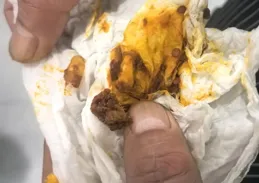 陜西神木市一學校餐廳吃出異物？校方辟謠