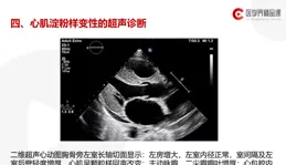 心臟超聲診斷入門