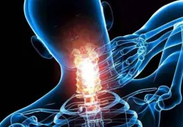 你認可頸椎病大多是椎骨錯位嗎？