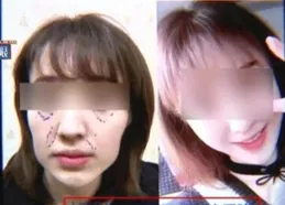 發自拍後被整容醫生關註了 | 冷段子3195 & 去年今日2842