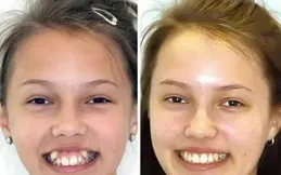 甚至可以看到給labubu戴牙套，這個醜萌醜萌的公仔真這麽吸引人麽