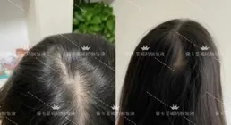 脫發最怕三個洗發水深度榜單，防脫洗發水排行榜親測好用權威解析