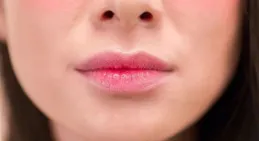 女子下巴腫如「西紅柿」 切開膿腫後竟然發現20多種細菌！