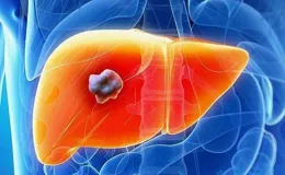 皮膚發黃、莫名乏力？可能肝臟出問題了，這些傷肝行為每天都在做