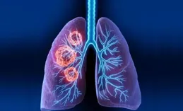 新研究發現可能抑制炎癥風暴的細胞膜「開關」