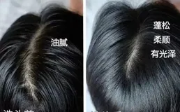 【618】99元大容量，禦方傳奇草本精華洗發露，助你恢復頭皮生態，頭發更靚麗！