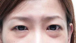 50歲梅婷生圖曝光，眼袋重似熊貓眼，皮膚狀態卻相當不錯！