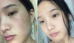 每天一道「美白菜」：3天黃氣退散！色斑淡了，素顏白到反光