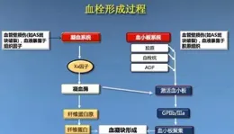 IBM取得用於形成焊料凸塊的系統和方法專利
